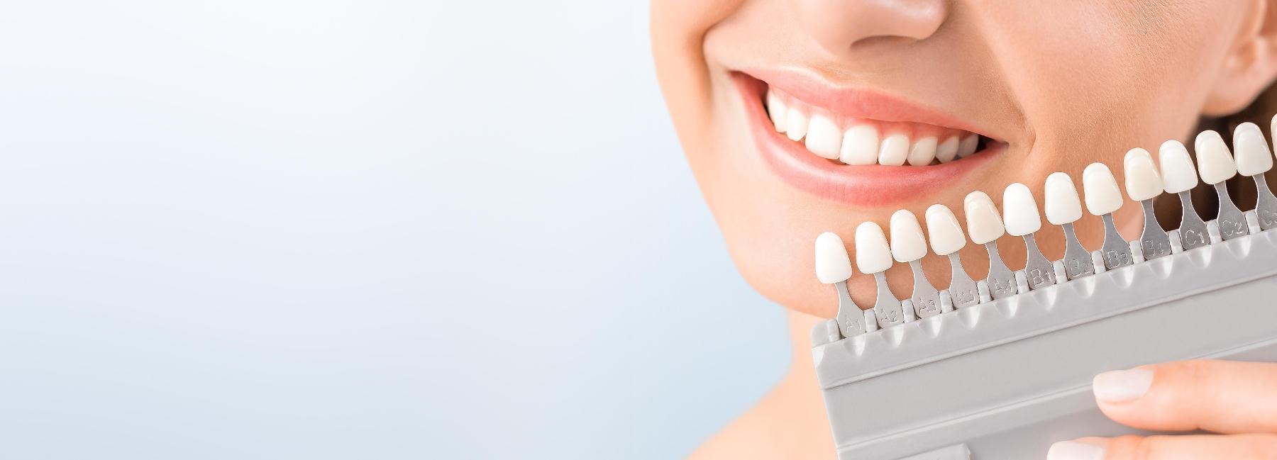 Close up of patient testing shades for teeth whitening Mitchell SD